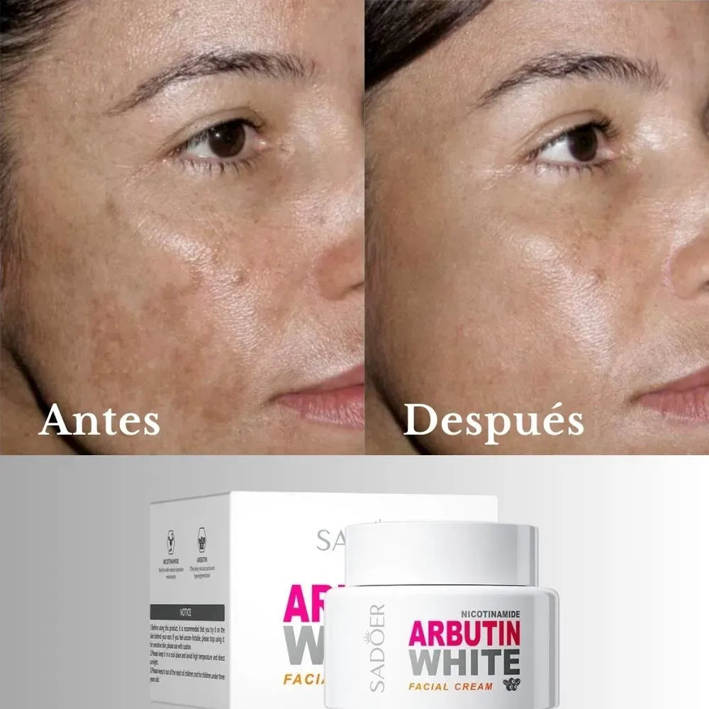 ARBUTIN+ ELIXIR ANTIEDAD🔥OFERTA LANAMIENTO SOLO POR 24 HORAS!